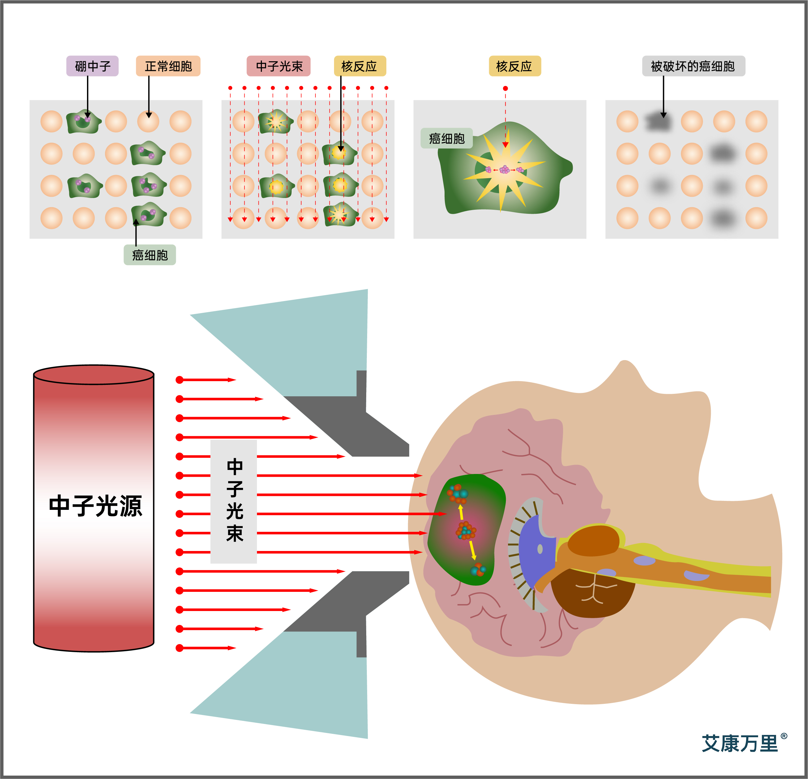 BNCT_画板 1 副本.jpg